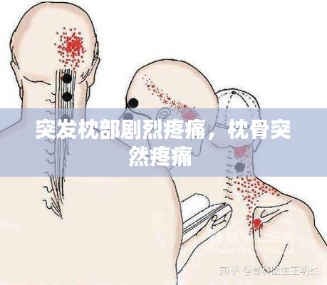 突发枕部剧烈疼痛,枕骨突然疼痛