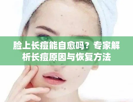 脸上长痘能自愈吗？专家解析长痘原因与恢复方法